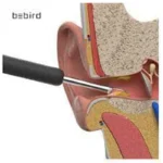 تصویر گوش پاک کن هوشمند شیائومی مدل Bebird R1 - سایت حامی تک